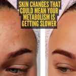 तुमची चयापचय क्रिया मंद होत असल्याची 5 त्वचेची चिन्हे