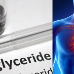 10 फळे जी नैसर्गिकरित्या ट्रायग्लिसराइड्स आणण्यास मदत करतात आणि 3 हृदय-निरोगी पाककृती